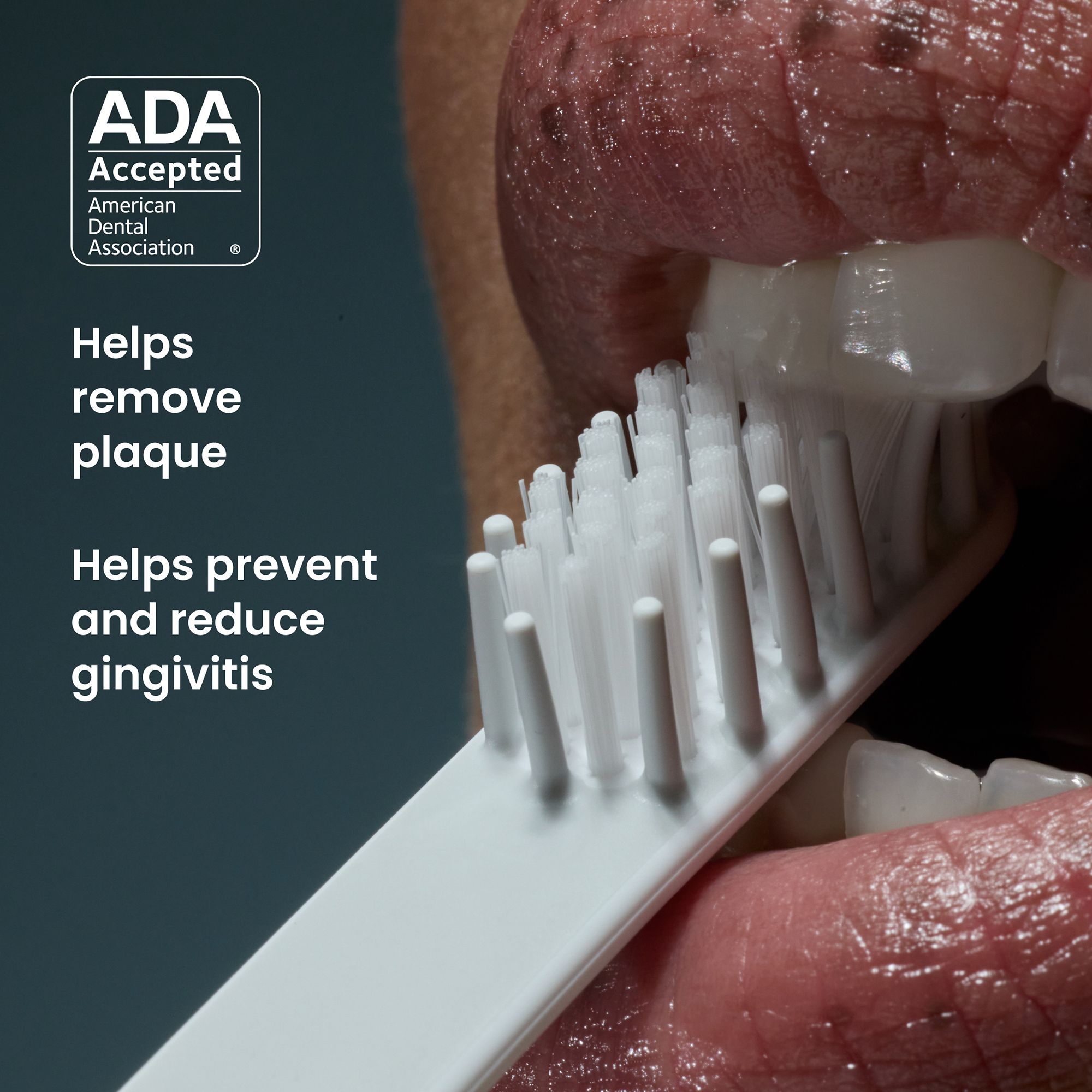 quip Sonic Electric Toothbrushes, Marine and Charcoal, with 4 Replacement Brush Heads, 2 pk.